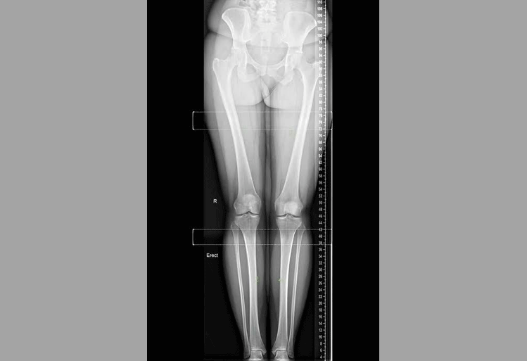 24 x 7 Digital Xray